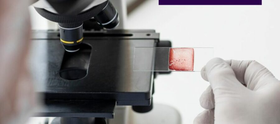 xr:d:DAF6sssVS_8:17,j:6246909065920780919,t:24012310 PathoGenX Labs Services: Comprehensive Pathology Test Offerings